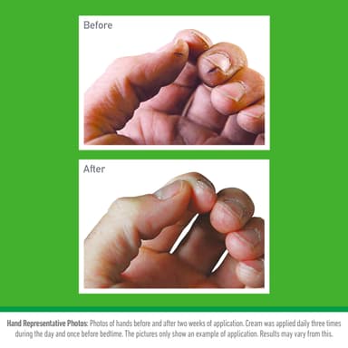 O'Keeffe's Working Hands, 96g Jar (2 Pack) - Hand Cream for Extremely Dry, Cracked Hands | Instantly Boosts Moisture Levels, Creates a Protective Layer & Prevents Moisture Loss view 3