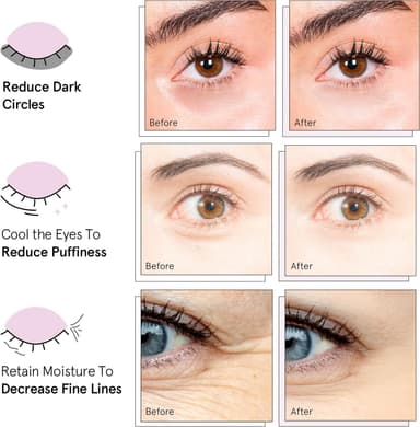grace & stella Award Winning Under Eye Mask - Reduce Dark Circles, Puffy Eyes, Undereye Bags, Wrinkles - Under Eye Gel Patches, Vegan Cruelty-Free Self Care (4 Pairs, Gold) view 3