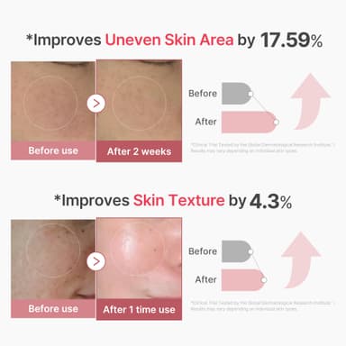 medicube PDRN Pink Collagen Exosome Shot Serum 2,000 PPM | Liquid Skin Booster | Exosome, Salmon DNA PDRN, Spicules | Uneven Skin Tone, Pore Care, Skin Texture | Korean Skin Care 1.01 fl.oz view 2