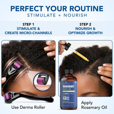Botanic Hearth Rosemary Oil for Hair Growth | Strengthening Biotin, Jojoba, Castor Hair Growth Oil for frizzy hair | Dry, Damaged Scalp Treatment | Color Safe | All Hair Types | 2 oz (+ Derma Roller) view 2
