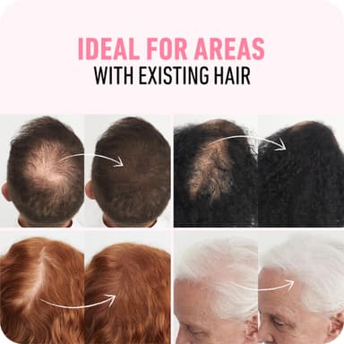BOLDIFY Hair Fibres (12.5g) - Fill In Thinning and Fine Hair for an Instantly Fuller, Thicker Look - 14 Shades for Women and Men - Dark Blonde view 4