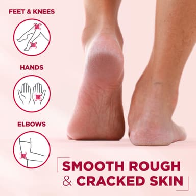 Mixa Balm, 10-in-1 Cica Repair Ointment, Repairing Balm for Cracked and Rough Skin, with 40% Glycerin, Urea and Allantoin, Suitable for Slugging and Foot Care, 150ml view 4