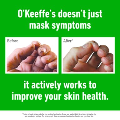 O'Keeffe's Working Hands, 80ml Tube - Hand Cream for Extremely Dry, Cracked Hands | Instantly Boosts Moisture Levels, Creates a Protective Layer & Prevents Moisture Loss view 4
