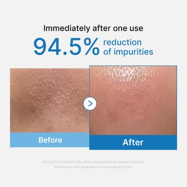 medicube Zero Pore Blackhead Cleansing Oil | Makeup Remover for all skin types, Daily Moisture Facial Cleanser, Low-Irritation | Korean Skin Care 205 ml view 2